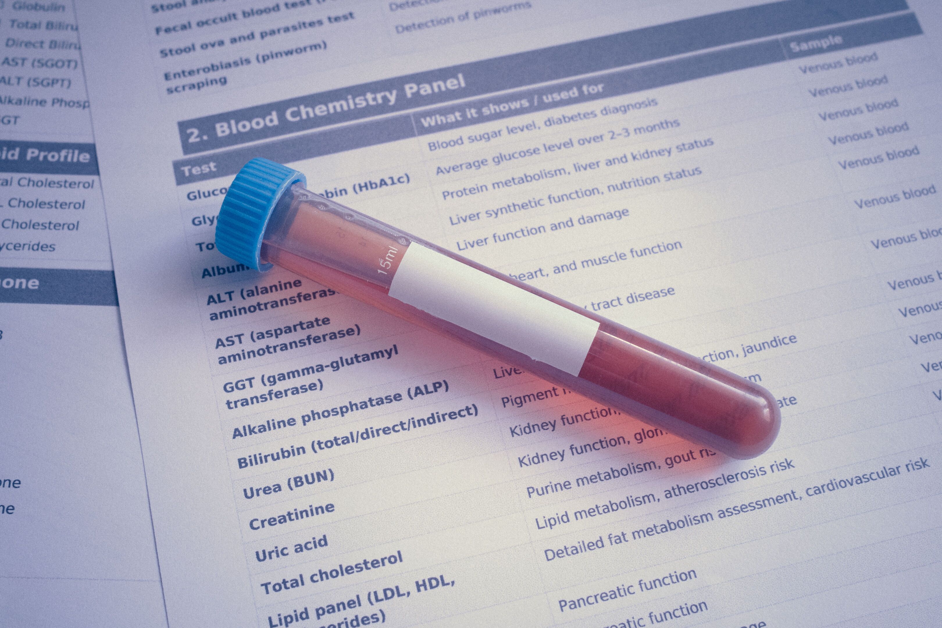 Blood sample tube lying on a printed blood chemistry panel with glucose and HbA1c rows